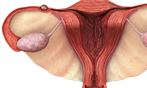 Ectopic Pregnancy