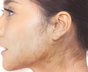 Gerstenberger recommends best of Why am i growing facial hair facial Why growing hair i am