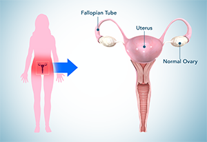 Pelvic Pain Treatment London, UK, Urinary Tract Infection Harrow